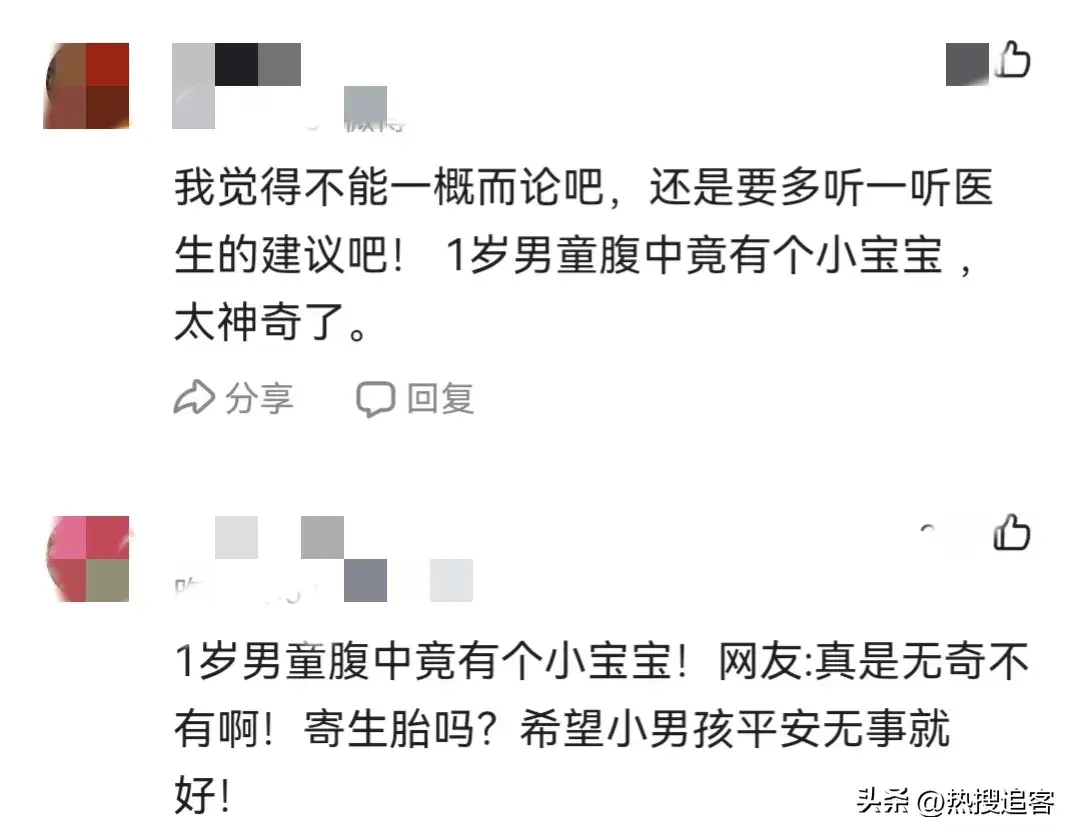 网友：真是无奇不有啊！寄生胎吗？(图4)