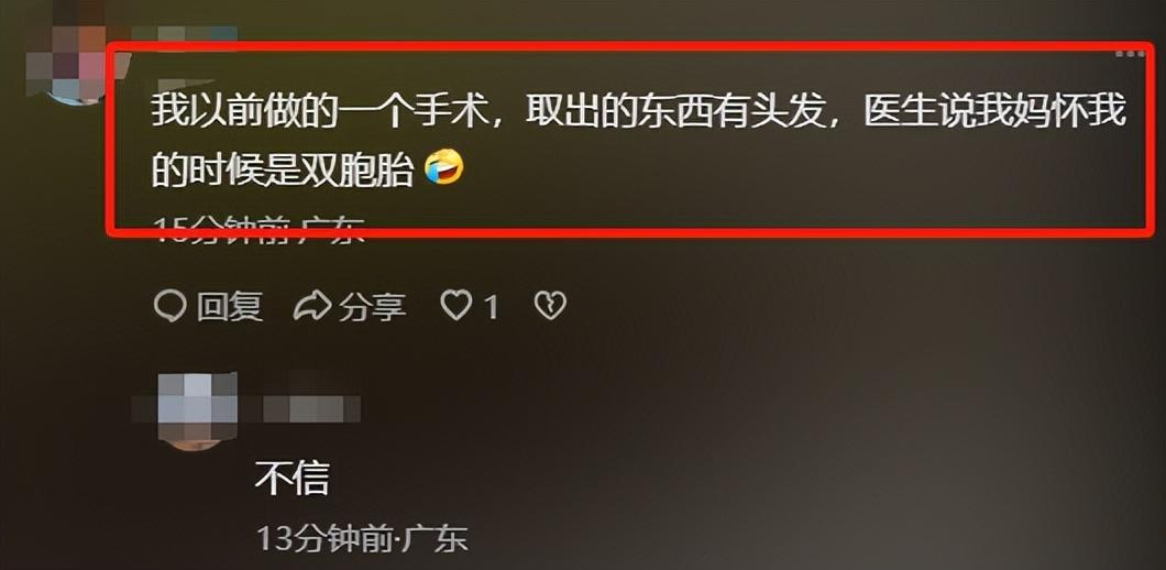 闹大了！1岁男童腹中竟有个小宝宝，评论区网友炸锅了-80棋牌(图6)